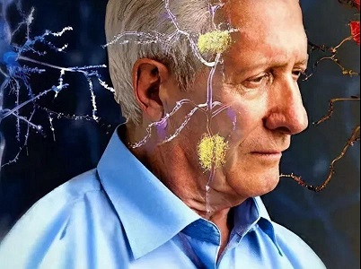 老年痴呆与口腔：洁牙能预防老年痴呆，真的吗？