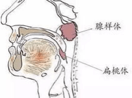 矫正牙齿前竟然要先看耳鼻喉科？ 