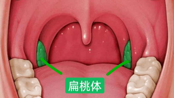 矫正牙齿前竟然要先看耳鼻喉科？ 