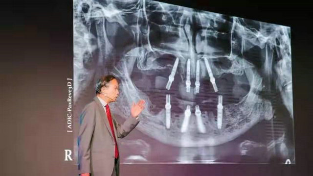 “即刻”引领口腔种植数字化新未来