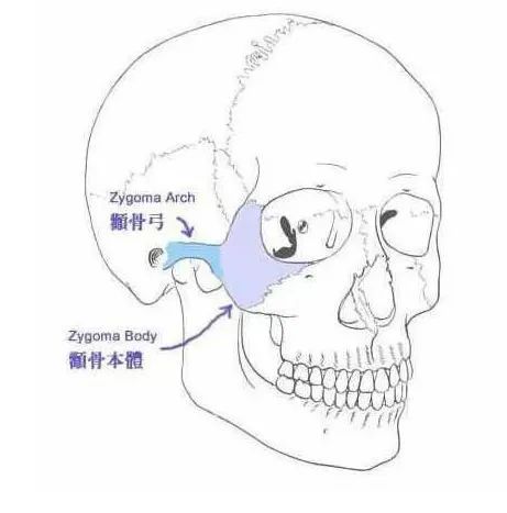 正畸如何预防牙套脸及法令纹