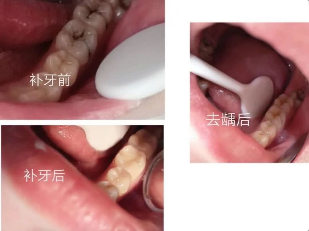 口腔常见小问题和自我处理方法！