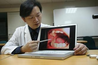 想要远离口腔癌，还请做好这5个预防措施