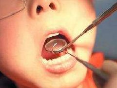 小孩子什么时候拔乳牙最好，那些情况需要拔乳牙？