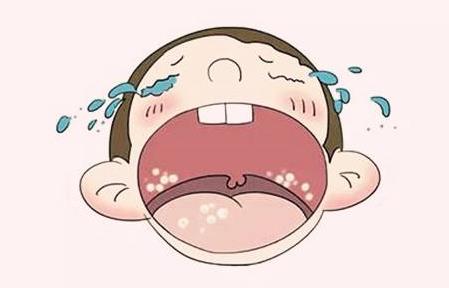 一岁半宝宝口腔溃疡怎么办