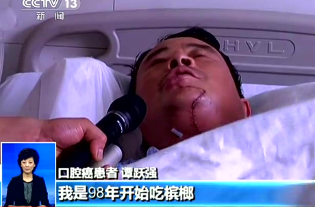 吸烟、喝酒、嚼槟榔？小心这种癌症找上门